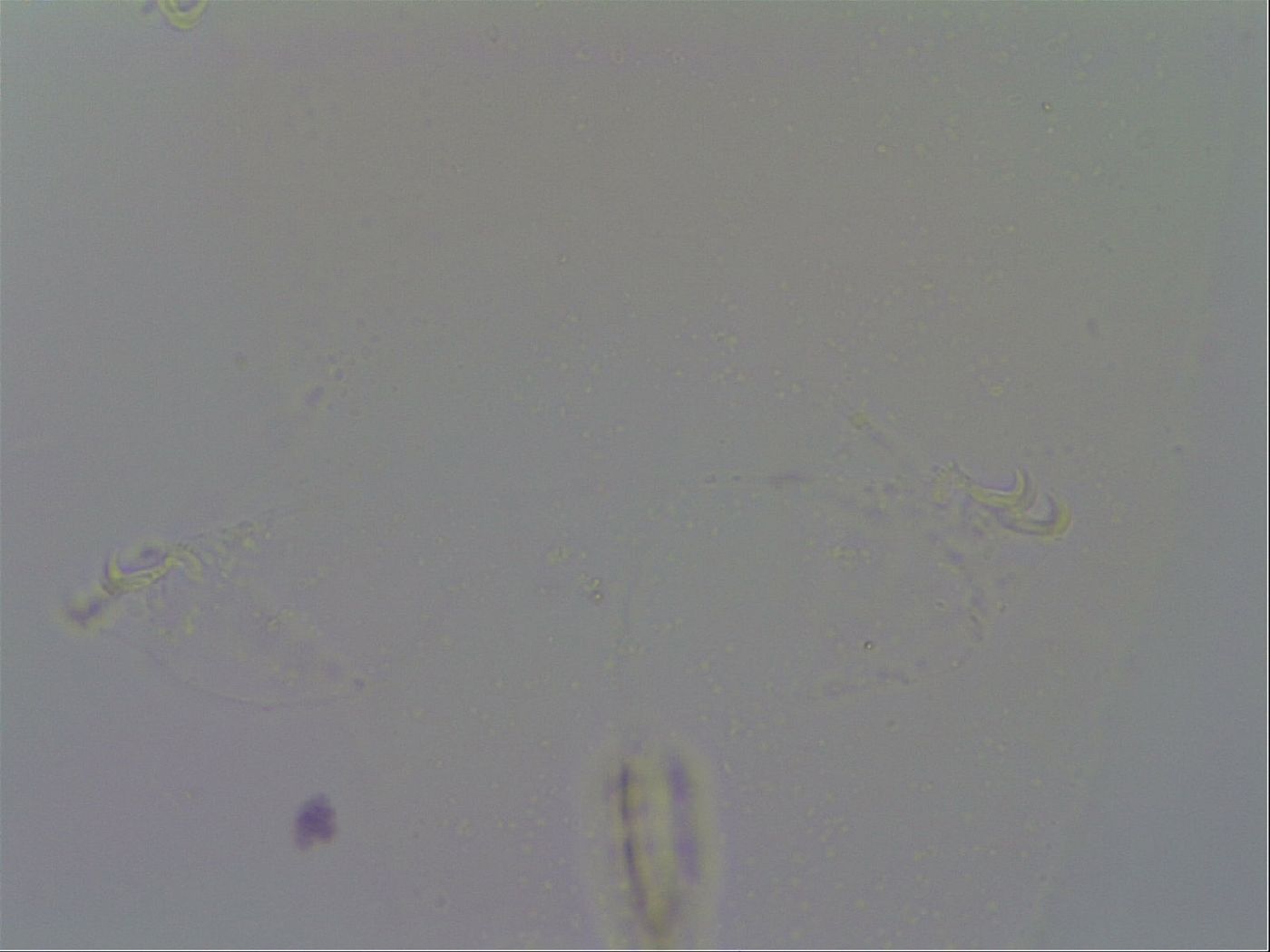 Macrobiotus echinogenitus image
