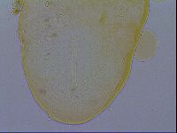Macrobiotus echinogenitus image