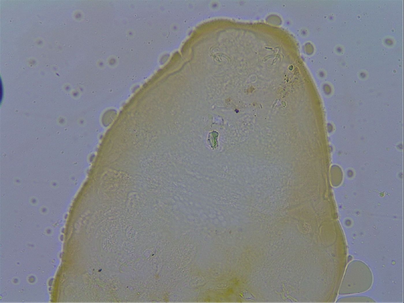Macrobiotus echinogenitus image