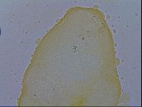 Macrobiotus echinogenitus image