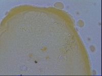 Macrobiotus echinogenitus image