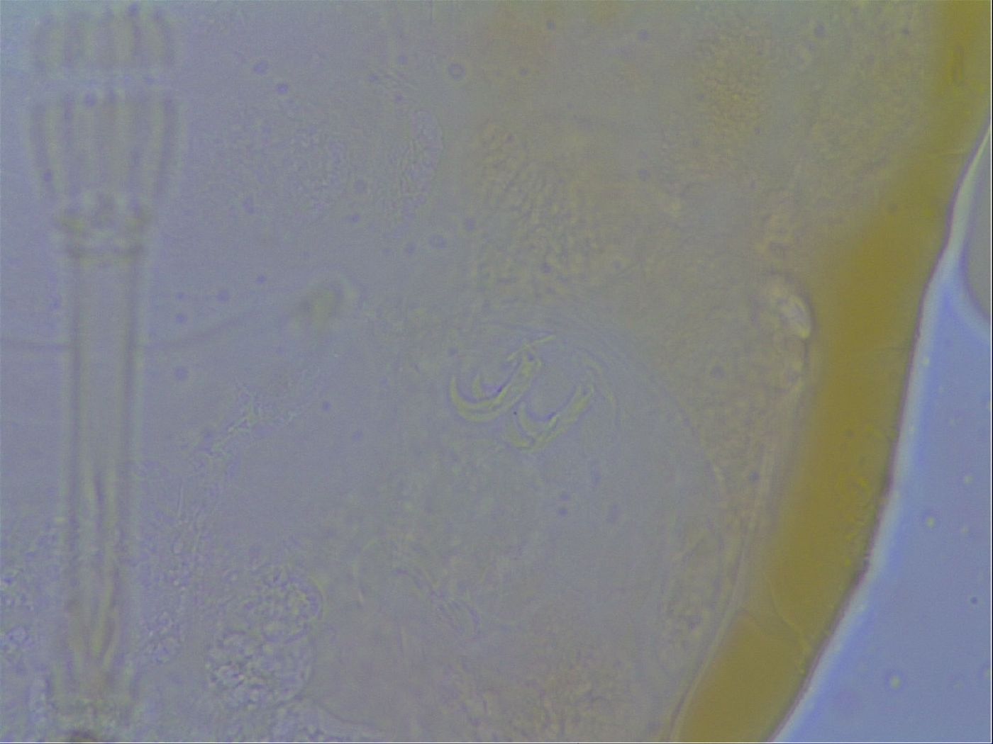 Macrobiotus echinogenitus image