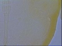 Macrobiotus echinogenitus image