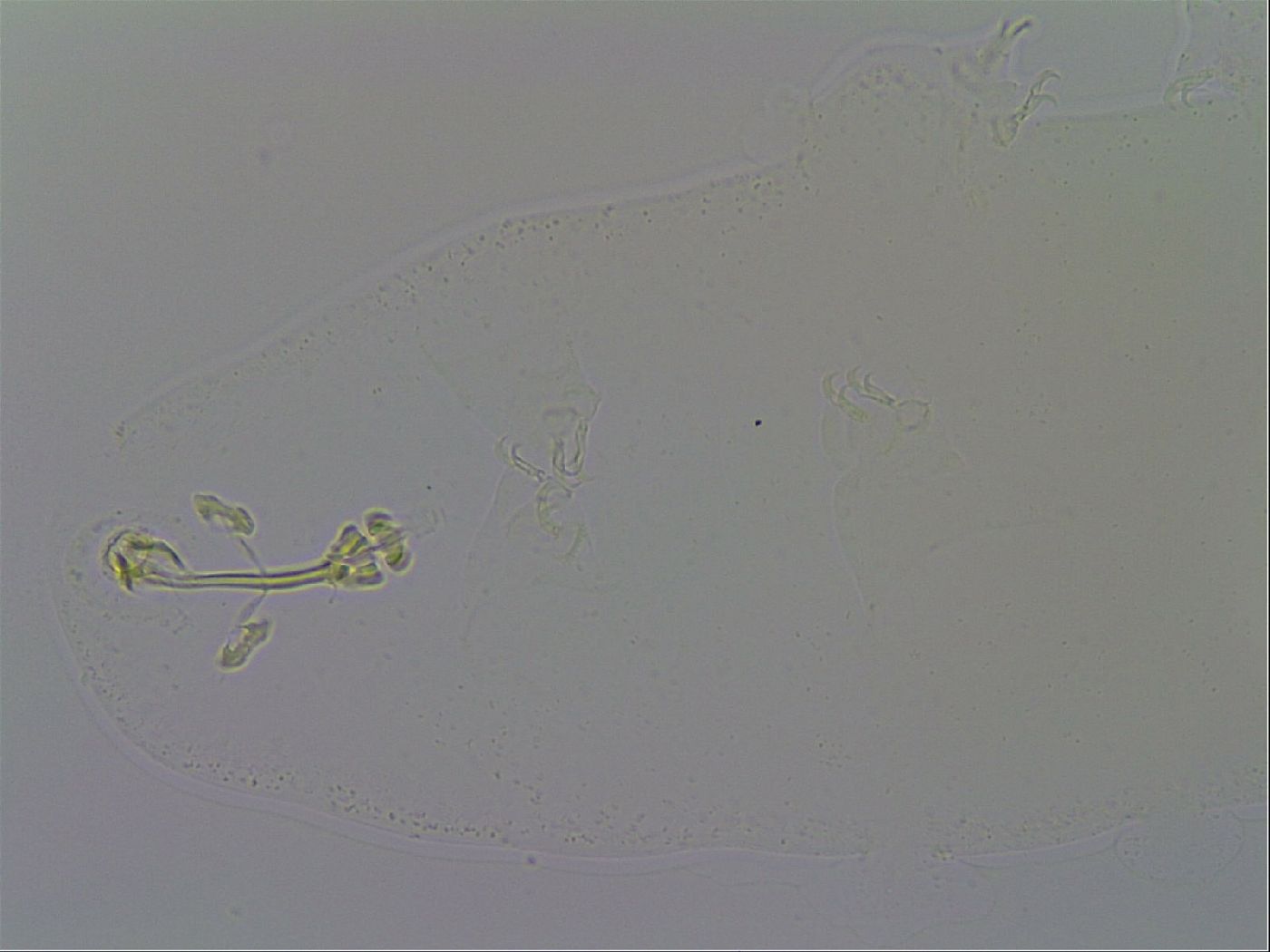 Richtersius coronifer image