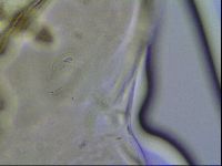 Richtersius coronifer image