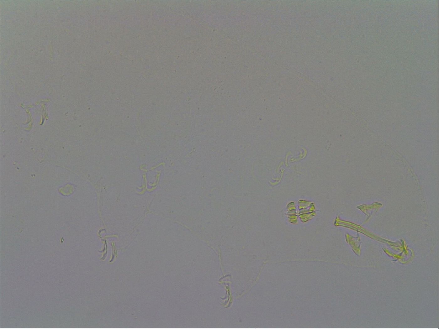 Richtersius coronifer image