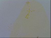 Media resource of Richtersius coronifer