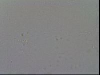 Mesobiotus furciger image