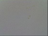 Mesobiotus furciger image