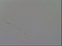 Mesobiotus furciger image