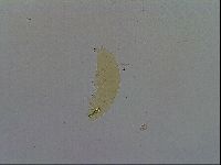 Mesobiotus furciger image