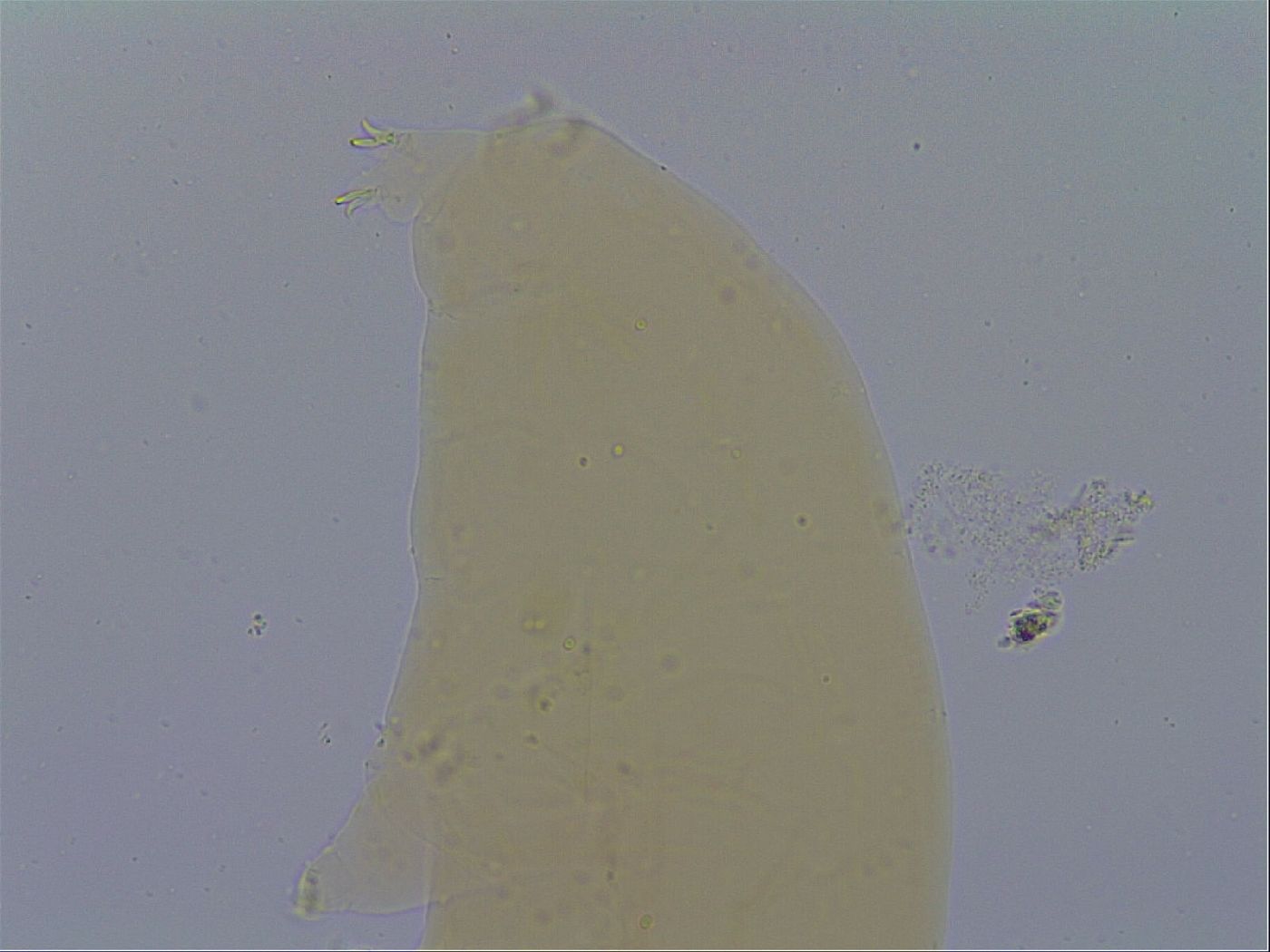 Mesobiotus furciger image