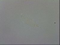 Mesobiotus furciger image