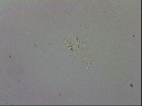 Mesobiotus furciger image