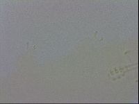 Mesobiotus furciger image