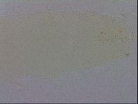 Mesobiotus furciger image