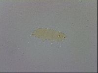 Mesobiotus furciger image