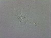 Mesobiotus furciger image