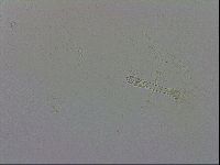 Mesobiotus furciger image