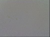 Mesobiotus furciger image