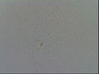 Mesobiotus furciger image