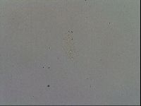Mesobiotus furciger image