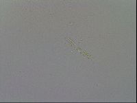 Mesobiotus furciger image