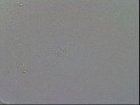 Mesobiotus furciger image