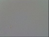 Mesobiotus furciger image