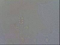 Mesobiotus furciger image