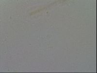 Mesobiotus furciger image