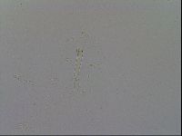 Mesobiotus furciger image