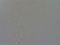 Mesobiotus furciger image