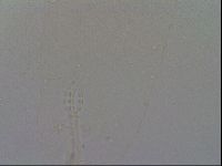 Mesobiotus furciger image