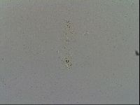 Mesobiotus furciger image