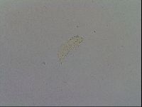 Mesobiotus furciger image