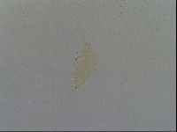Mesobiotus furciger image
