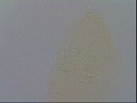 Mesobiotus furciger image