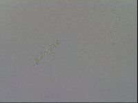 Mesobiotus furciger image