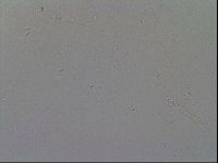 Mesobiotus furciger image