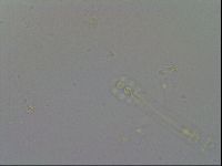 Mesobiotus furciger image