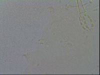 Mesobiotus furciger image
