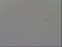 Mesobiotus furciger image