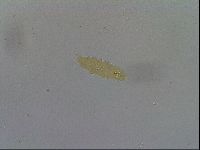 Mesobiotus furciger image