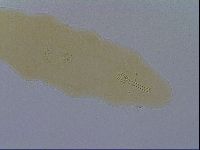 Mesobiotus furciger image