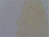 Mesobiotus furciger image