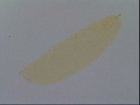 Paramacrobiotus areolatus image
