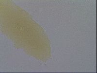 Mesobiotus furciger image