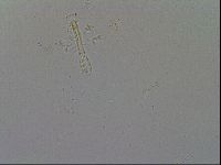 Mesobiotus furciger image