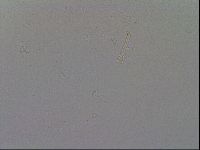 Mesobiotus furciger image